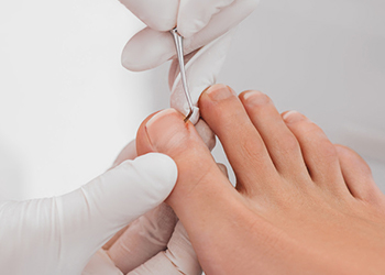 切らなくて痛くない治療