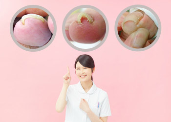 どんな爪の形でも対応可能